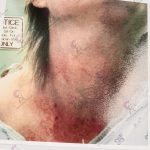 Decade Old Assault Allegations Against Judicial Candidate Surface 